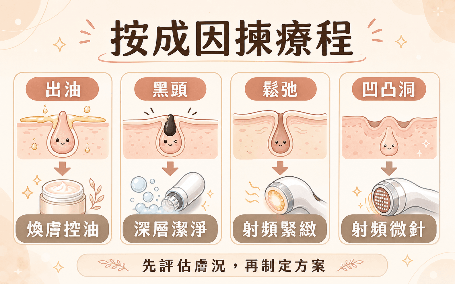 按成因揀收毛孔療程 IG 風格插畫