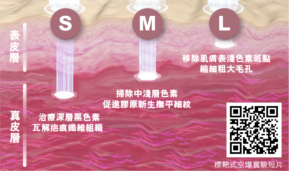 三段式聚焦示意