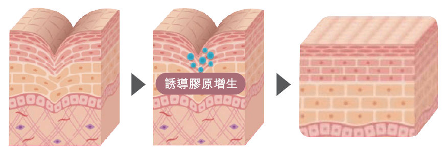 LIOB 空穴效應示意