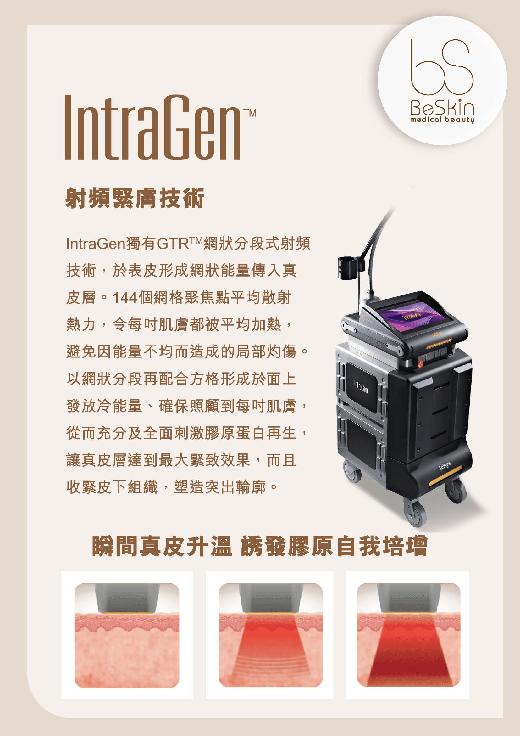 IntraGen 射頻緊膚可用於鬆弛型毛孔評估