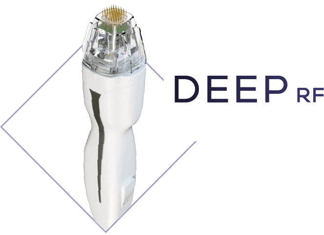 DEEP RF 治療頭