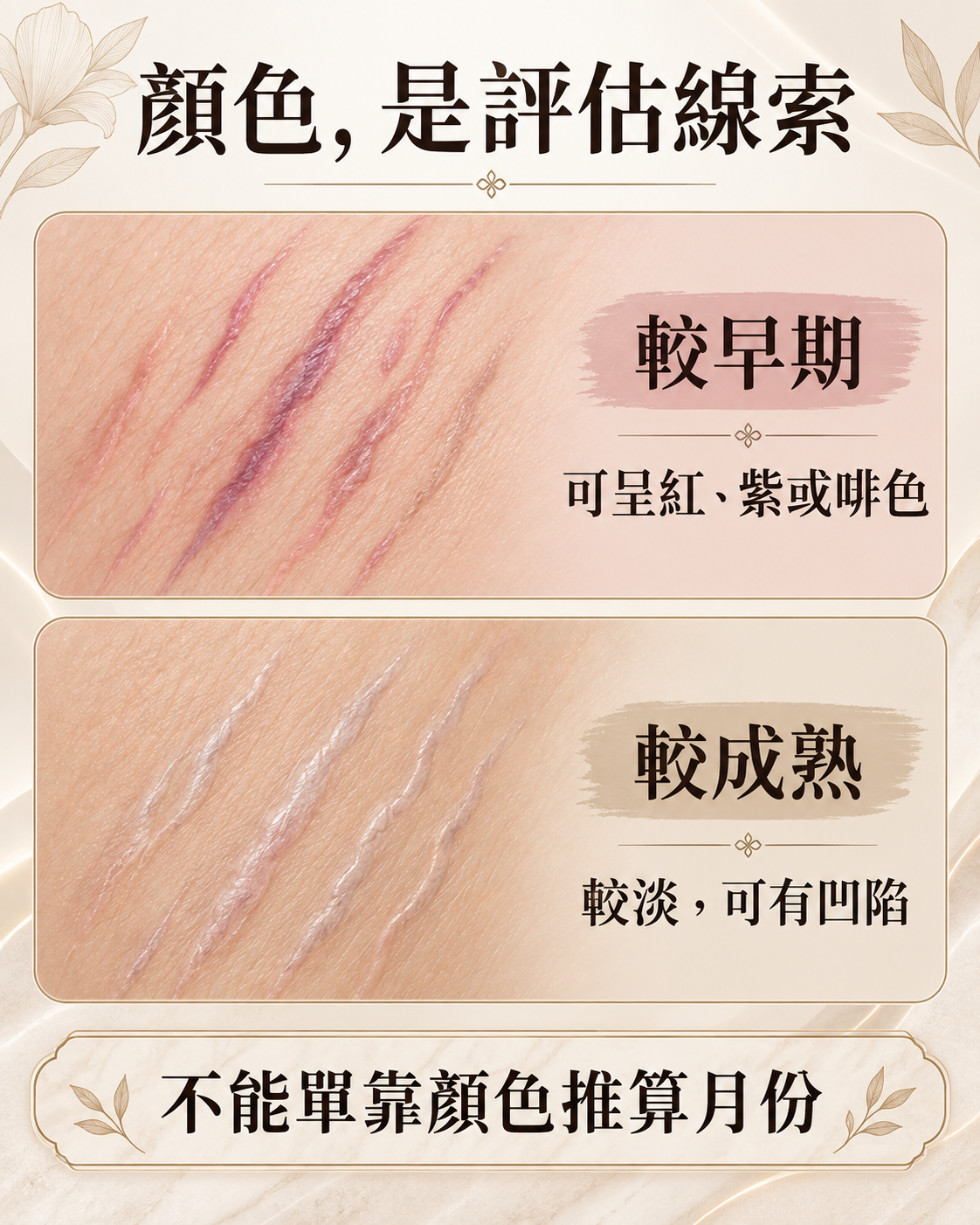 較早期紅紫色條紋與較成熟淡白色條紋比較,提醒顏色不能推算準確月份
